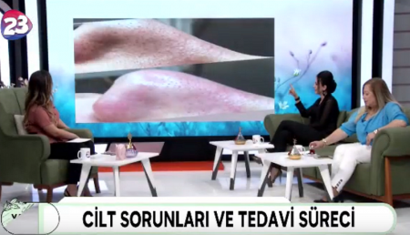 MELİSA İLE YAŞAMA DAİR /  105. PROGRAM
